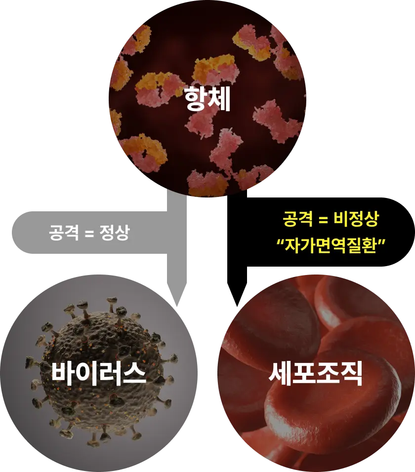 자가면역 질환 도식