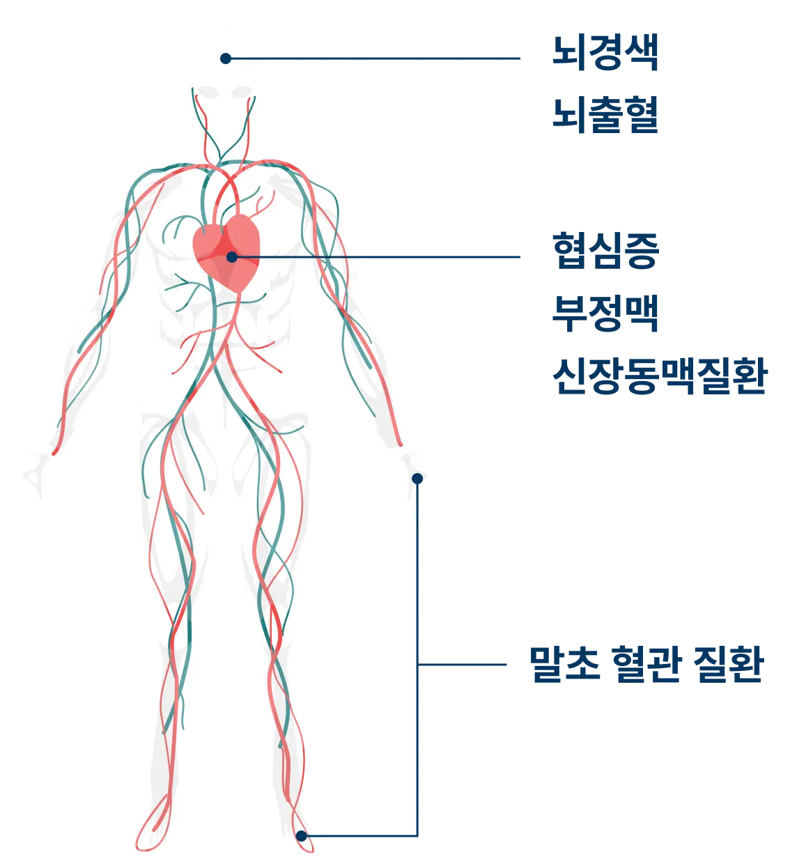 인체 혈관 구조와 질환 도표