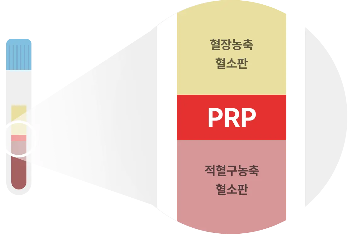 PRP