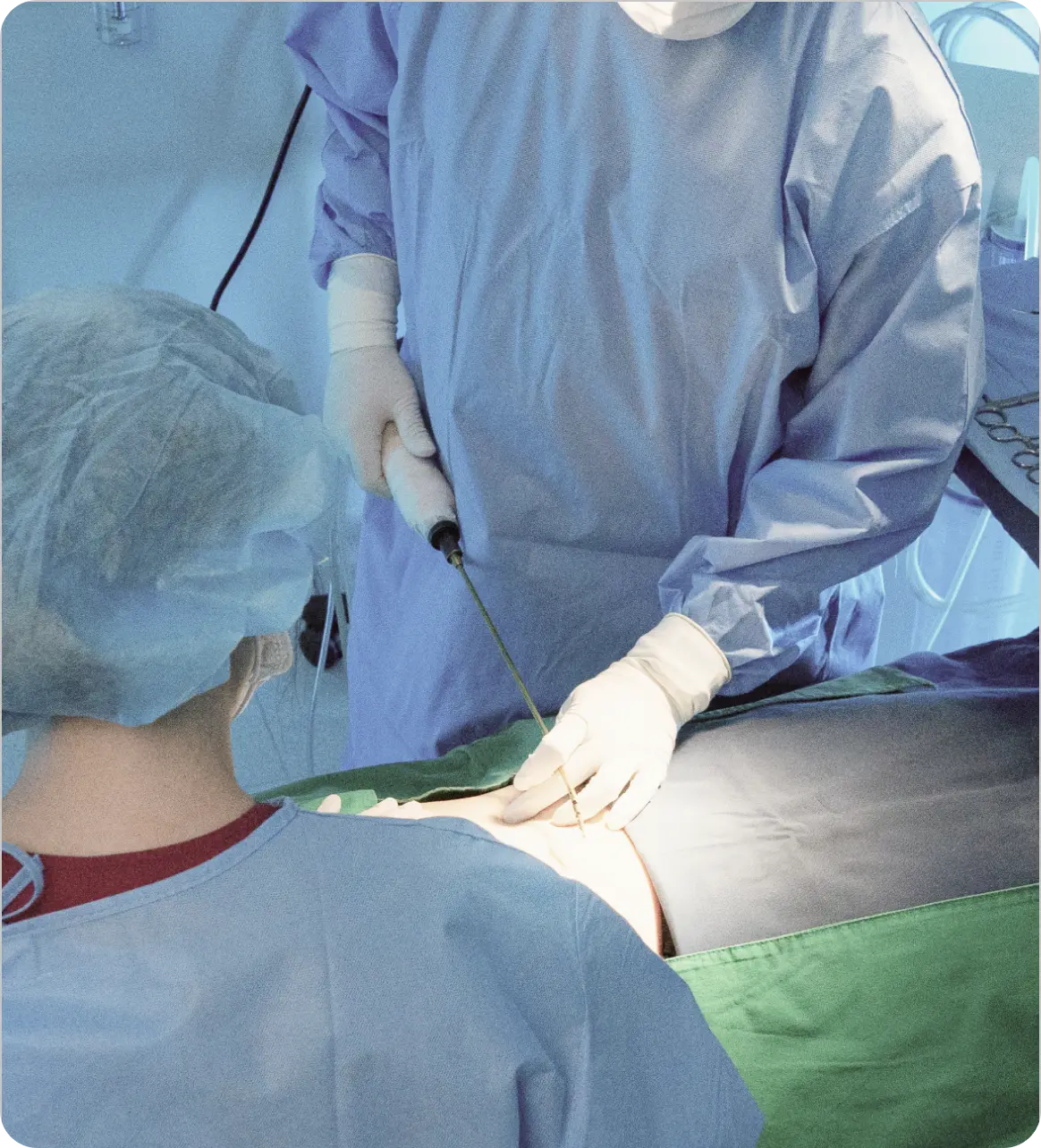 Fat harvesting for ECM extraction during RegenMat preparation