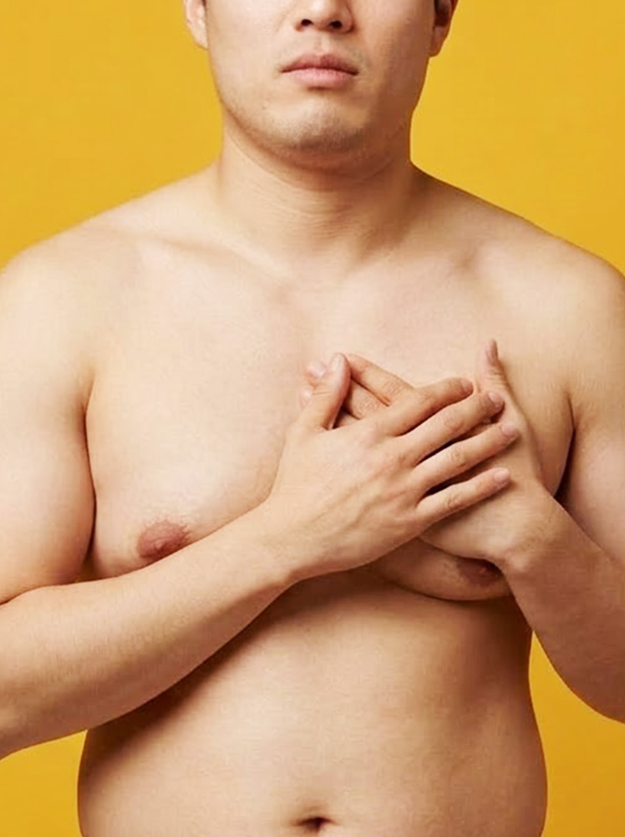 여유증 수술 잘못하면 더 이상해집니다
