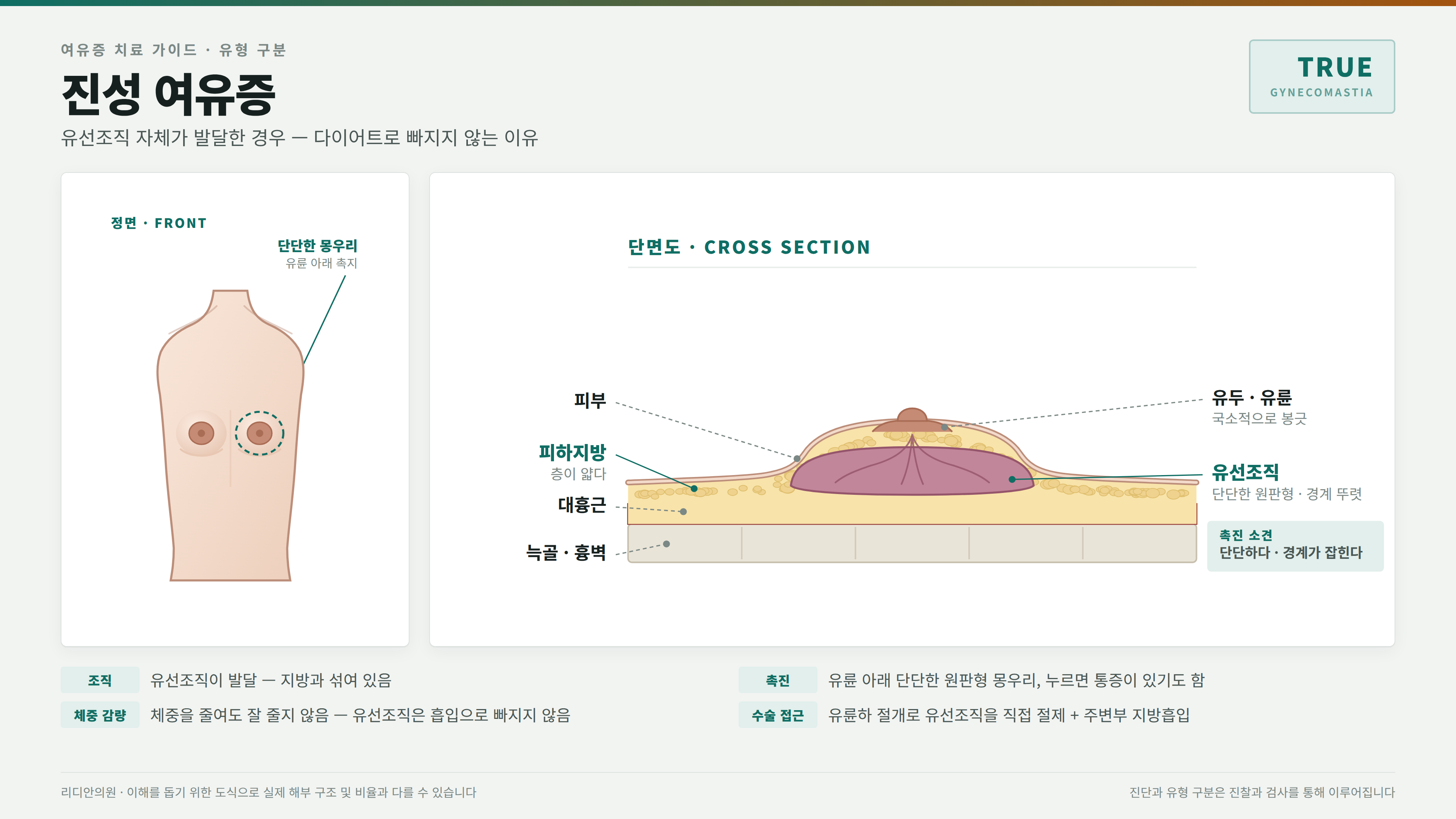 진성 여유증